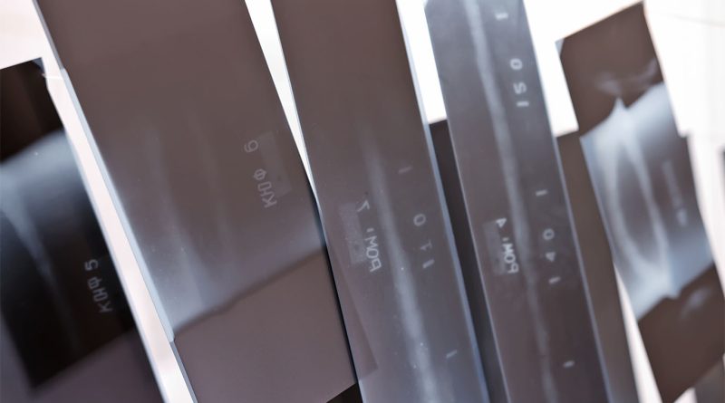 radiographic film for NDT materials article